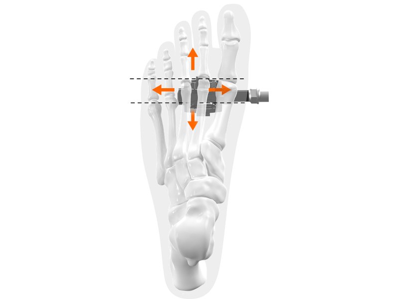 dolor de pies en el ciclismo