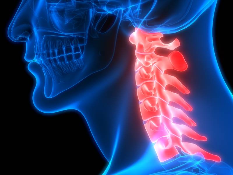 dolor cervical