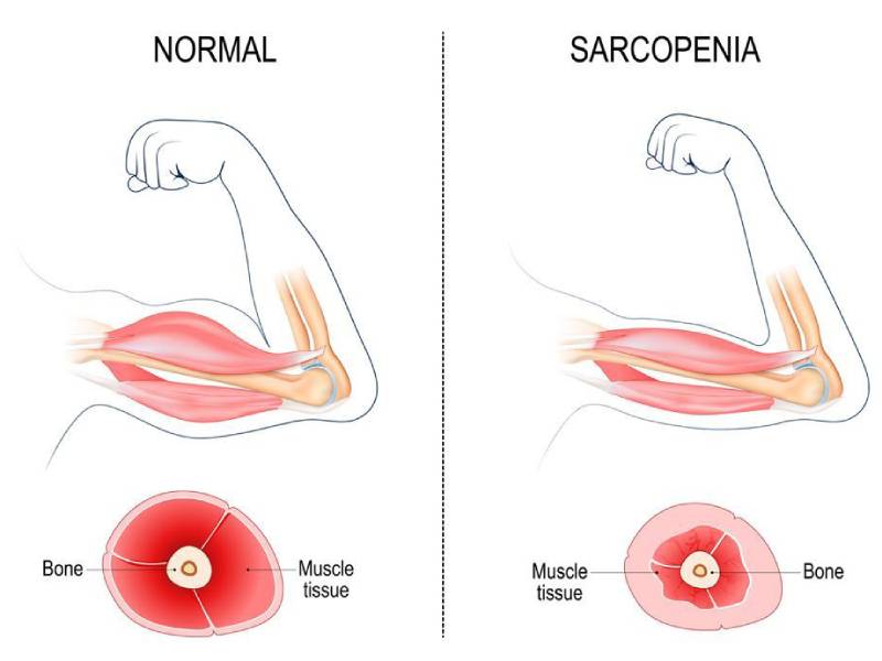 cómo evitar perder masa muscular