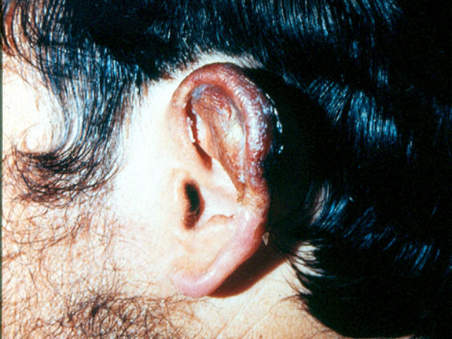 cuerpo cuando llegar el fío