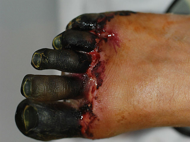 cuerpo cuando llegar el fío