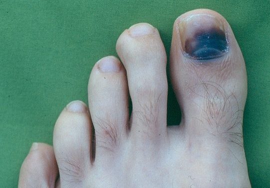 Consejos para cuidar los pies en la montaña