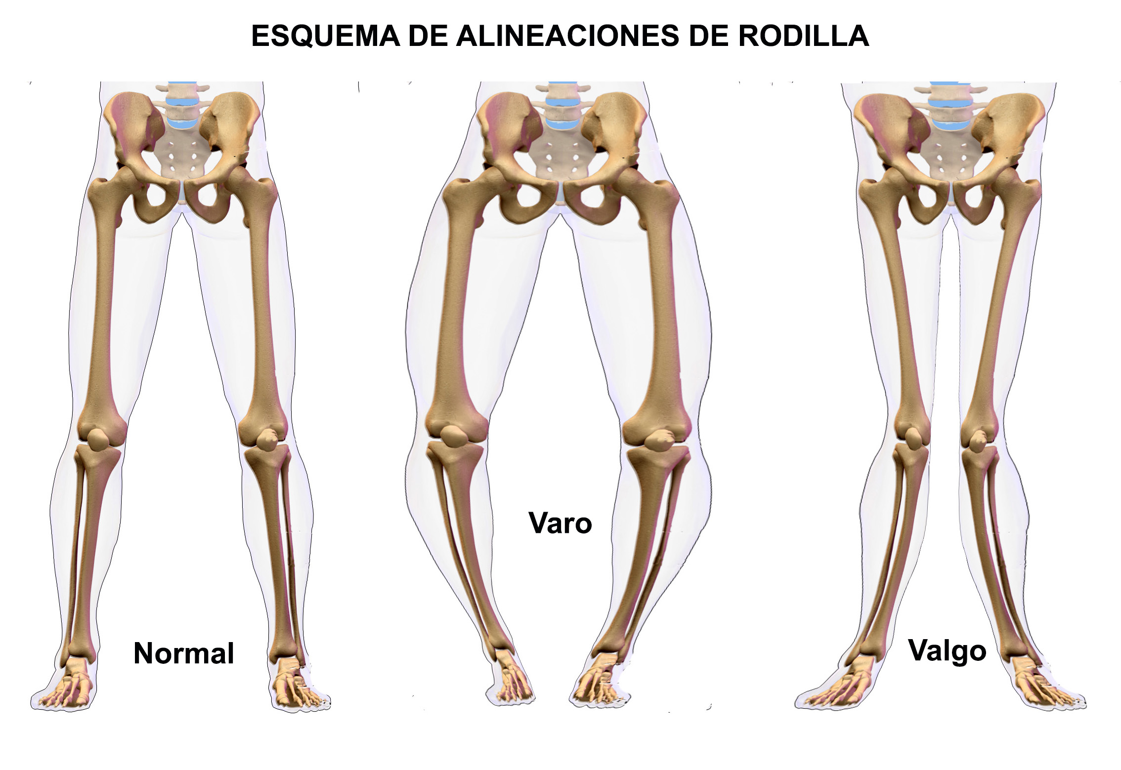 cuidar las articulaciones en la montaña