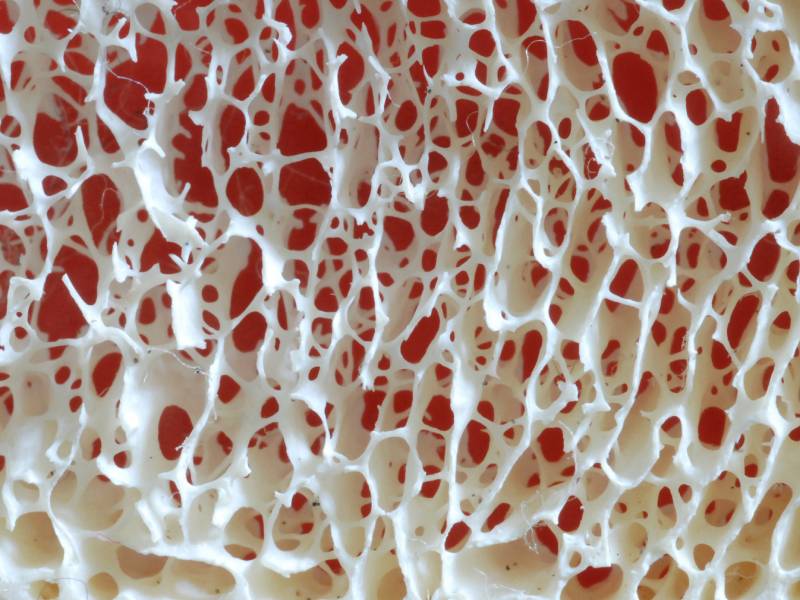 Tengo osteoporosis: ¿debo dejar la actividad en la montaña?
