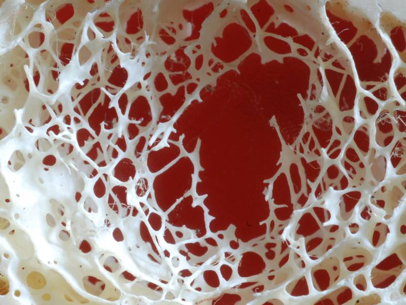 Tengo osteoporosis: ¿debo dejar la actividad en la montaña?