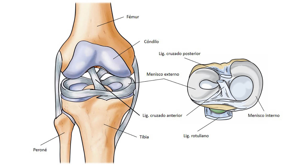 tendinitis rotuliana