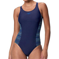 Placement Muscleback One Piece